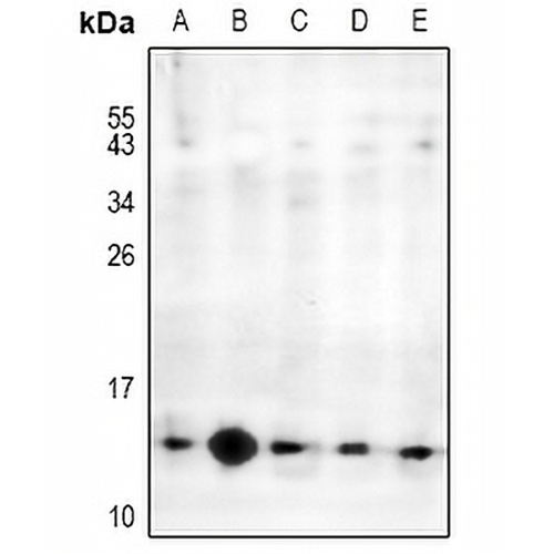 MED21 Rabbit Polyclonal Antibody