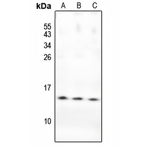 PKI beta Rabbit Polyclonal Antibody