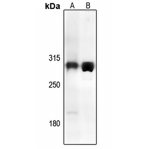 TRAP240 Rabbit Polyclonal Antibody