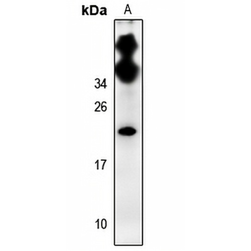 CDC50C Rabbit Polyclonal Antibody