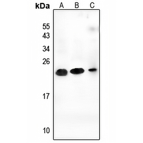CEND1 Rabbit Polyclonal Antibody