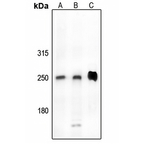CDK5RAP2 Rabbit Polyclonal Antibody