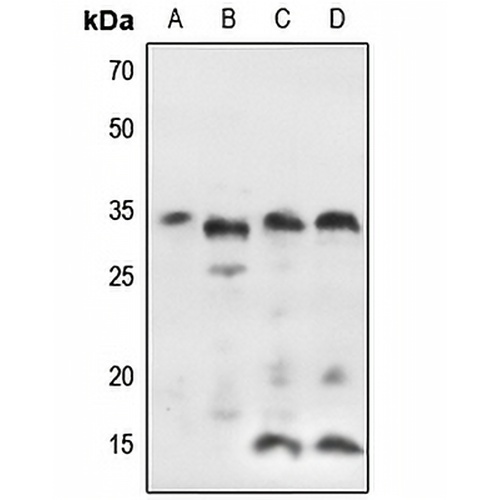 IGFBP7 Rabbit Polyclonal Antibody