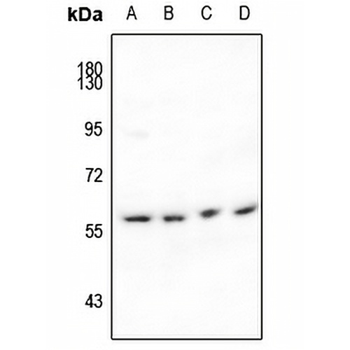 IFIT1 Rabbit Polyclonal Antibody