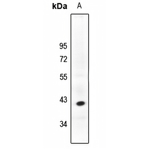 PHLDA1 Rabbit Polyclonal Antibody