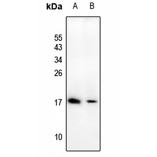 ATP5D Rabbit Polyclonal Antibody