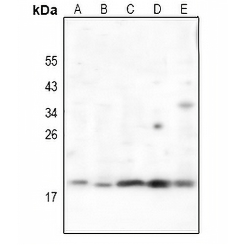RCL Rabbit Polyclonal Antibody