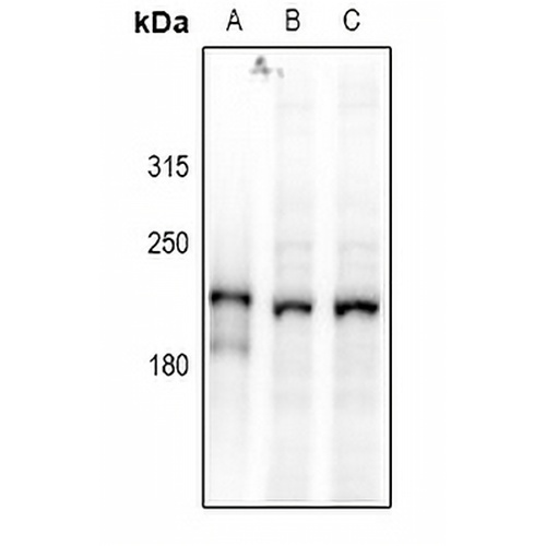 DOCK2 Rabbit Polyclonal Antibody