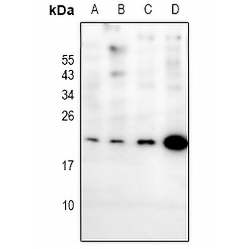 EIF1AY Rabbit Polyclonal Antibody