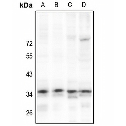 NKX2-4 Rabbit Polyclonal Antibody