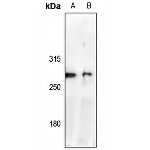 NAV2 Rabbit Polyclonal Antibody
