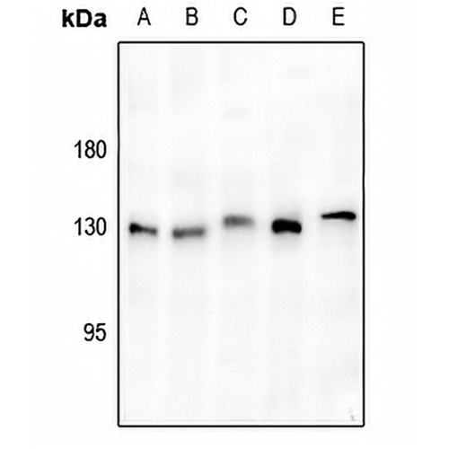 ULK1 Rabbit Polyclonal Antibody