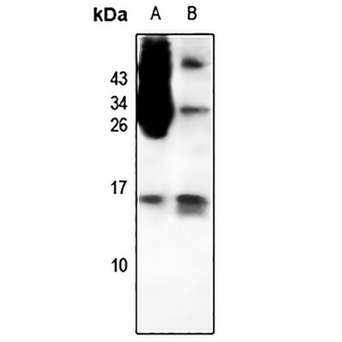 CCL1 Rabbit Polyclonal Antibody