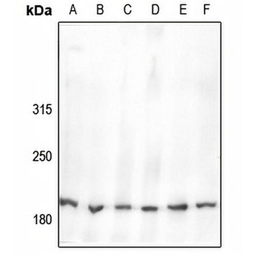 Nav1.2 Rabbit Polyclonal Antibody