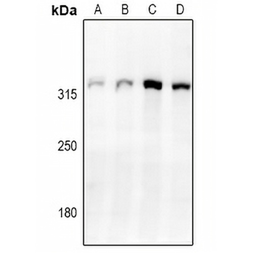 Cav3.2 Rabbit Polyclonal Antibody