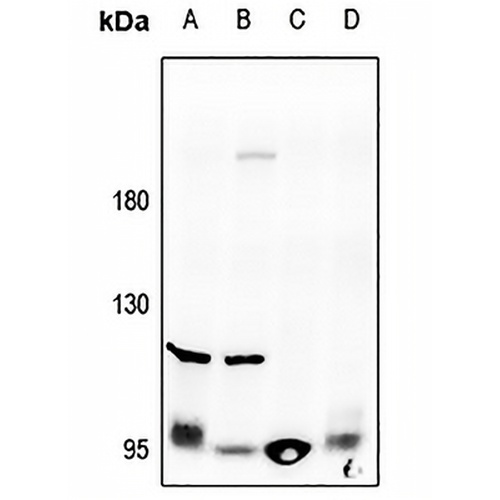 Collagen 2 alpha 1 Rabbit Polyclonal Antibody