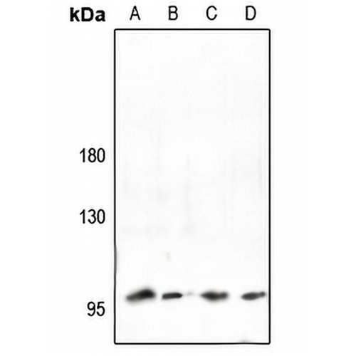 Collagen 2 alpha 1 Rabbit Polyclonal Antibody