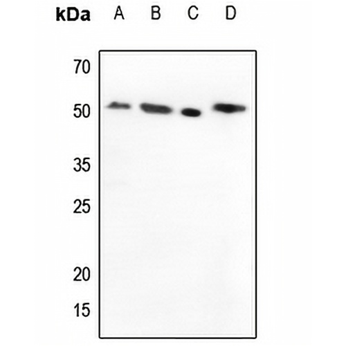 MMP1 Rabbit Polyclonal Antibody