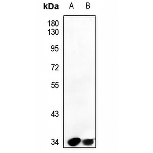 PAR4 Rabbit Polyclonal Antibody