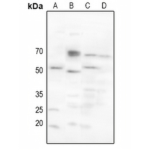 CHRM2 Rabbit Polyclonal Antibody