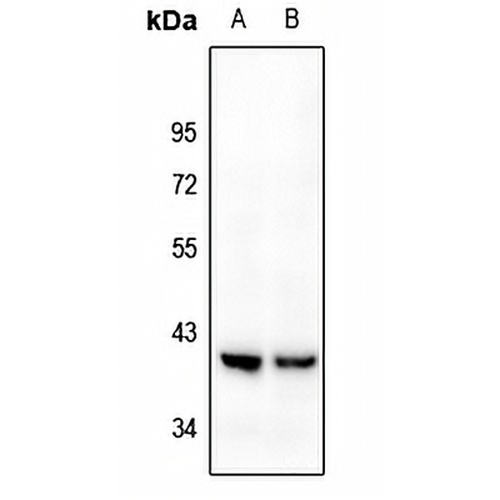 Kappa Opioid Receptor Rabbit Polyclonal Antibody