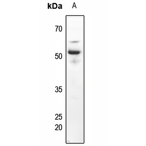 CD63 Rabbit Polyclonal Antibody
