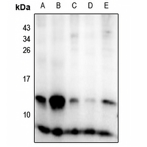 Insulin Rabbit Polyclonal Antibody