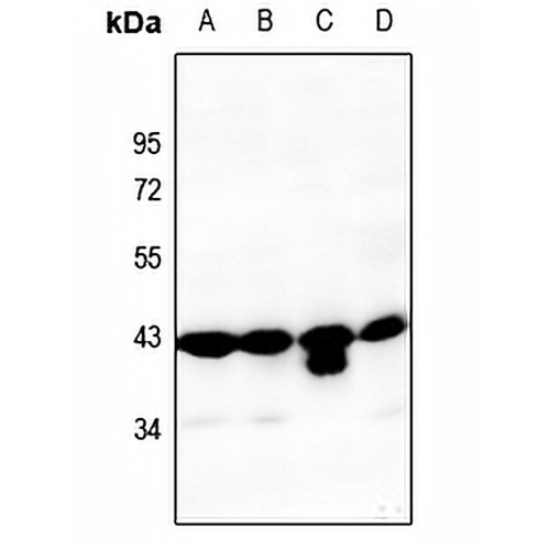 PAI1 Rabbit Polyclonal Antibody