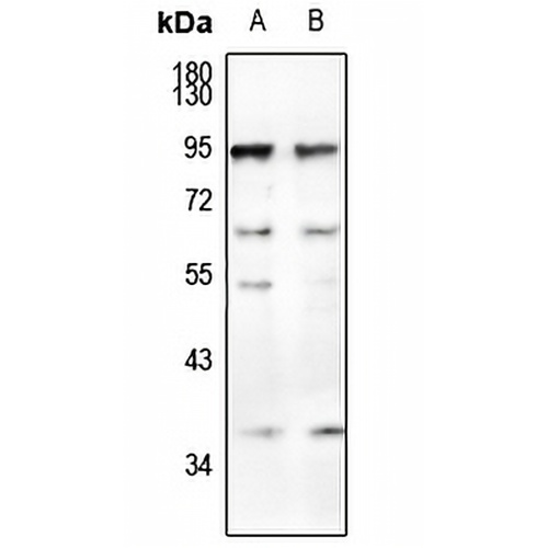 CD66a/b/c Rabbit Polyclonal Antibody