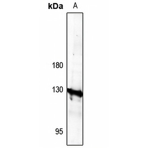 AE4 Rabbit Polyclonal Antibody
