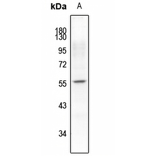 Synaptotagmin (Phospho-S309/306) Rabbit Polyclonal Antibody