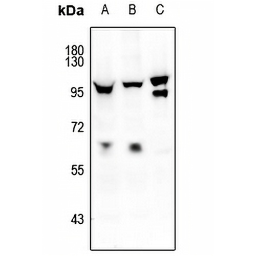 FOXO1/3/4 (Phospho-T24/32) Rabbit Polyclonal Antibody