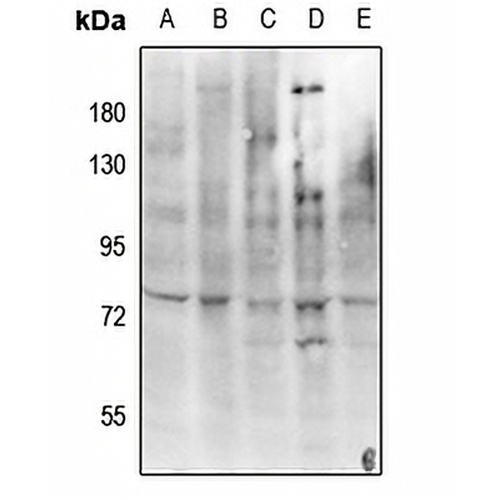 c-RAF (Phospho-Y341) Rabbit Polyclonal Antibody