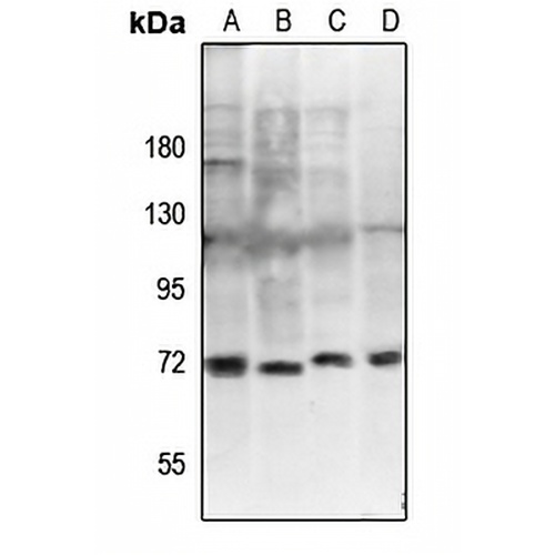 ZAP70 (Phospho-Y292) Rabbit Polyclonal Antibody