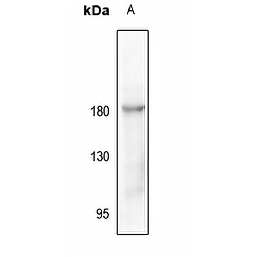 CD115 (Phospho-Y723) Rabbit Polyclonal Antibody