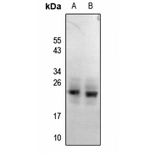 RGS1/8/16 (Phospho-Y187/159/168) Rabbit Polyclonal Antibody