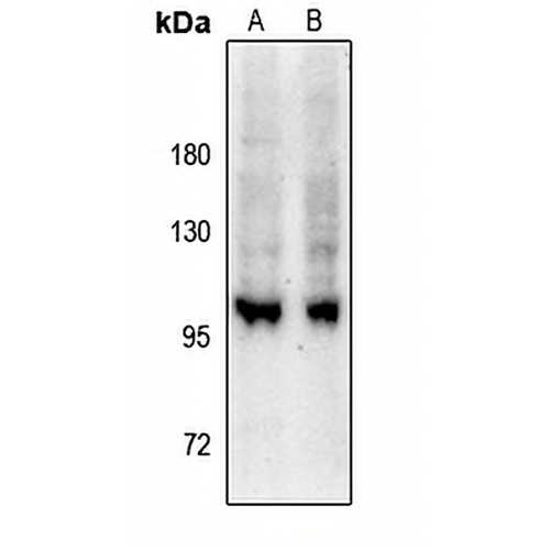 GEF H1 (Phospho-S885) Rabbit Polyclonal Antibody