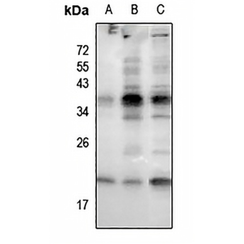 RAC1/2/3 (Phospho-S71) Rabbit Polyclonal Antibody