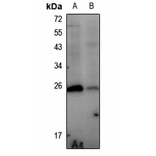 HSP27 (Phospho-S78) Rabbit Polyclonal Antibody