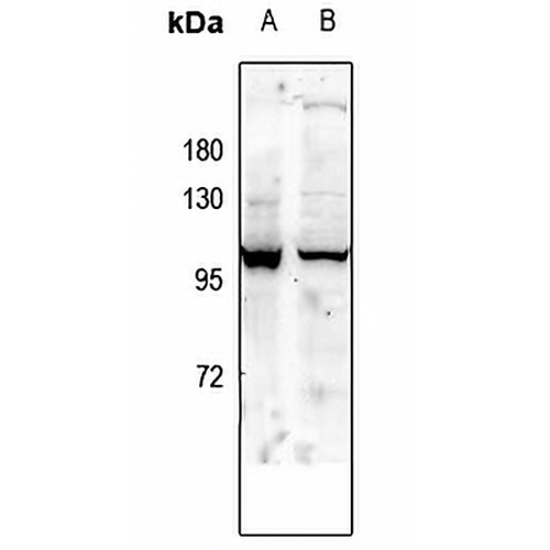 GLUR1 (Phospho-S863) Rabbit Polyclonal Antibody
