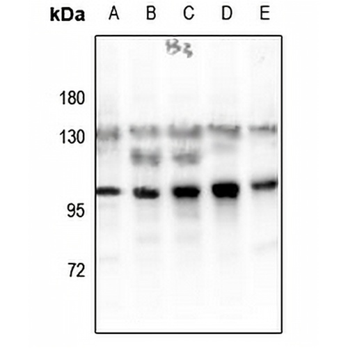 Glucocorticoid Receptor (Phospho-S203) Rabbit Polyclonal Antibody