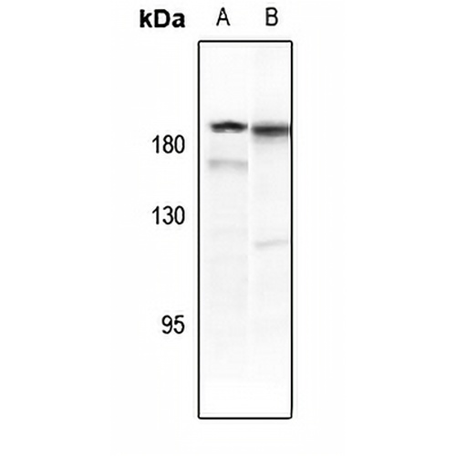 PDGFR beta (Phospho-Y771) Rabbit Polyclonal Antibody
