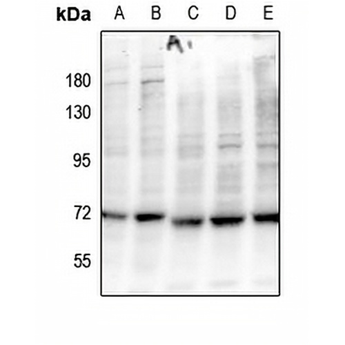 BLNK (Phospho-Y84) Rabbit Polyclonal Antibody