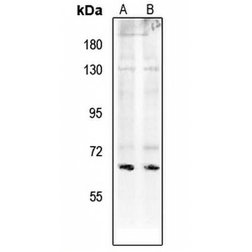 Paxillin (Phospho-S272) Rabbit Polyclonal Antibody