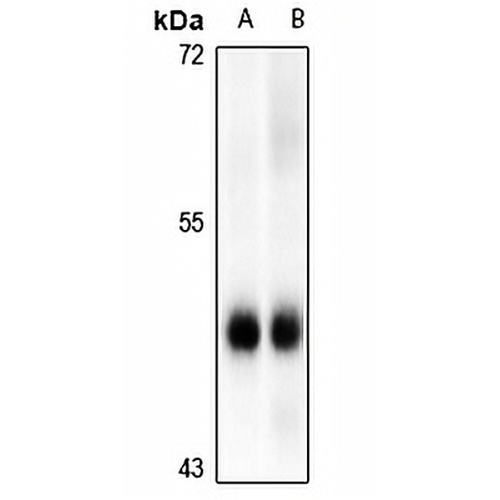 MK2 (Phospho-S272) Rabbit Polyclonal Antibody