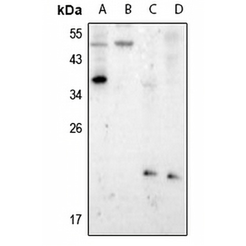 Presenilin 1 (Phospho-S357) Rabbit Polyclonal Antibody