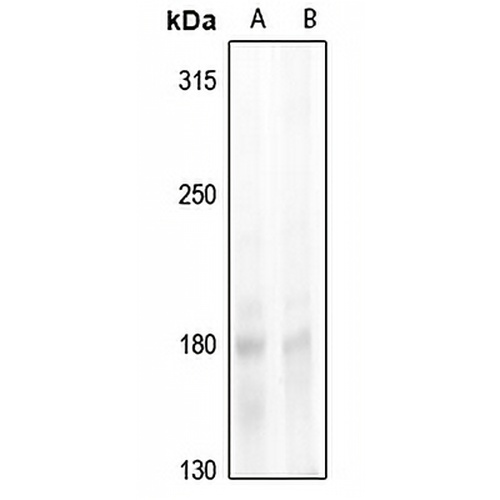 NCOA1 (Phospho-T1179) Rabbit Polyclonal Antibody