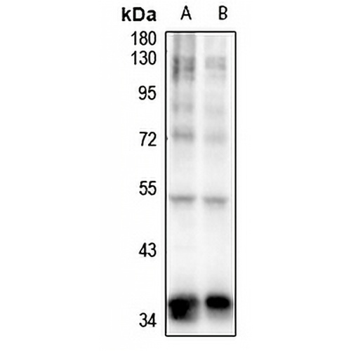 TOB (Phospho-S164) Rabbit Polyclonal Antibody