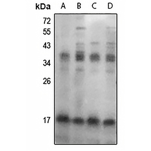 FHIT (Phospho-Y114) Rabbit Polyclonal Antibody