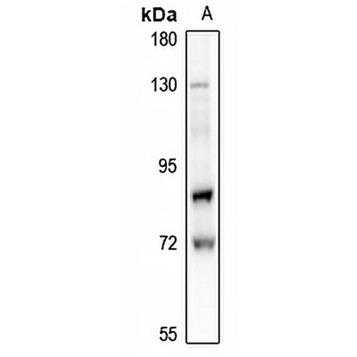 Lamin A/C (Phospho-S22) Rabbit Polyclonal Antibody